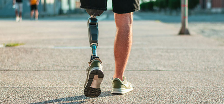 patient experiencing Phantom Limb Syndrome and in need of the neuropathy treatment protocol at Pittsburgh East Health Center in Monroeville